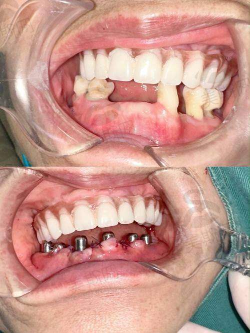 8、天津诺尔口腔门诊部2025价格表新查询