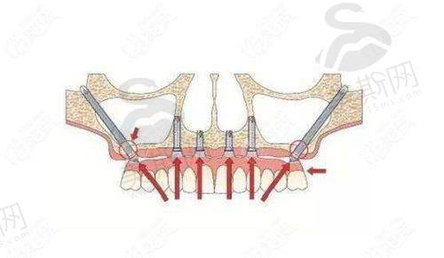 河南焦作植得口腔医院特色技术