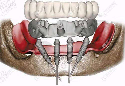 承德玥莱美医疗整形口腔医院怎么样？