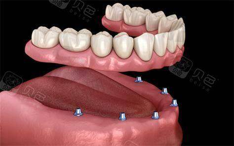 厦门麦芽口腔医院诊疗项目