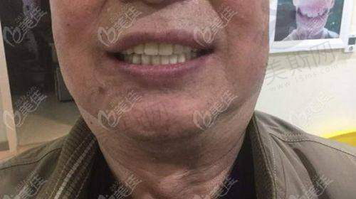 河南焦作植得口腔医院预约挂号