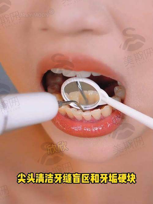 5、山西大同中诺口腔医院诊疗项目