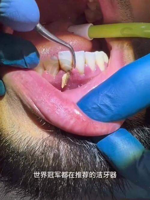 10、天津诺尔口腔门诊部地址电话及来院路线