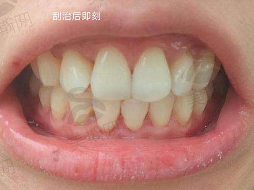结语