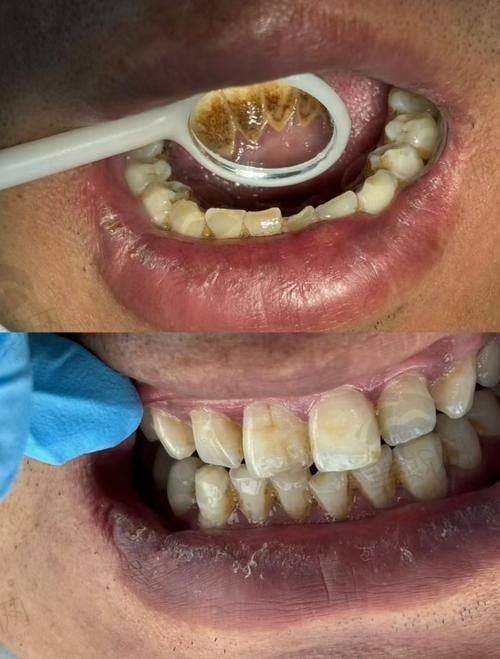 2、山西大同中诺口腔医院是正规医院吗?