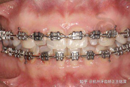 湖北武汉中诺口腔医院特色技术
