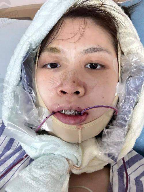 2、青海西宁诺贝尔口腔医院是正规医院吗?