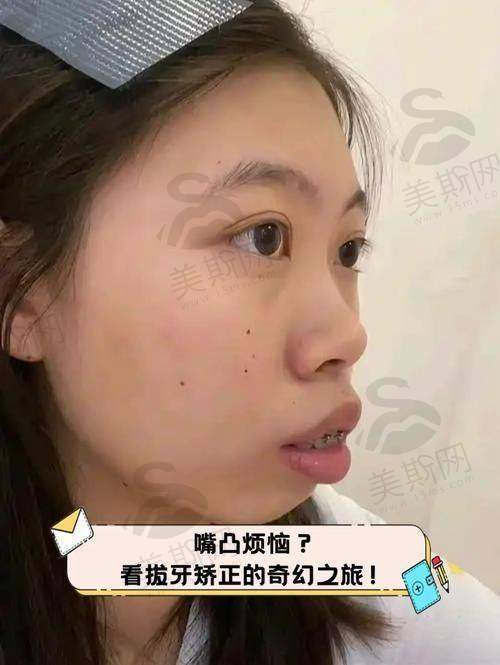 四川乐山达芬奇口腔医院真人口碑实例反馈