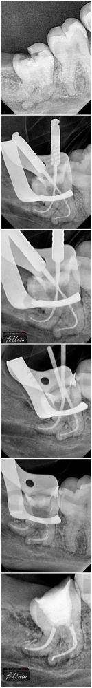西藏昌都摩尔口腔医院2025价格表新查询