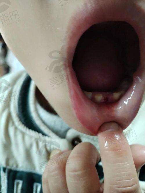 湖北宜昌爱合口腔医院特色技术