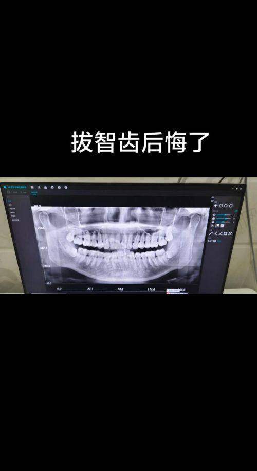 山东临沂壹颗芽口腔医院2025价格表新查询