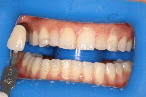 承德玥莱美医疗整形口腔医院是正规医院吗？