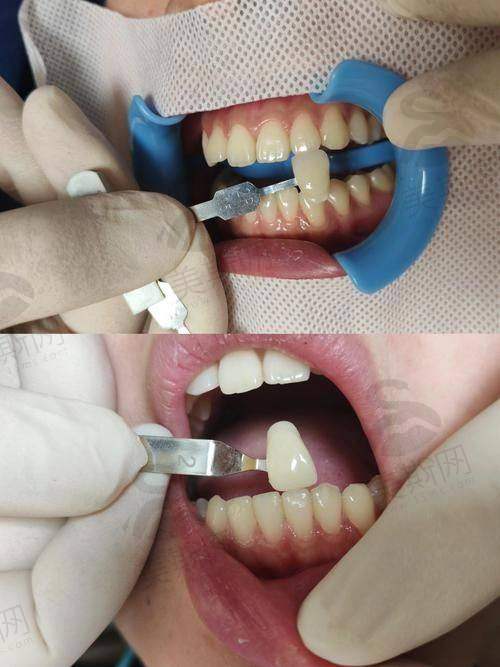 承德玥莱美医疗整形口腔医院预约挂号