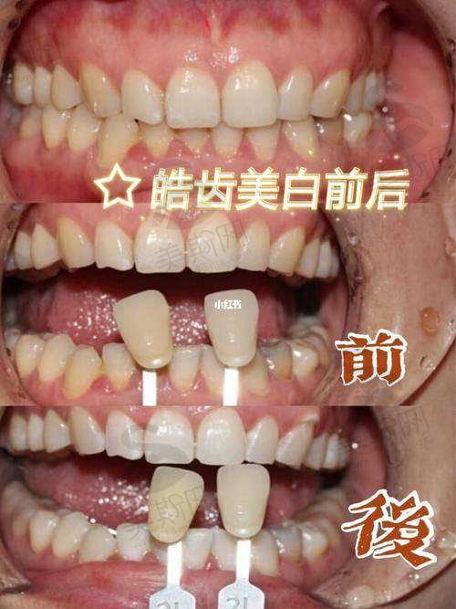 郑州唯美口腔医院是正规医院吗?