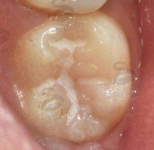 5、陕西咸阳彬州乐美口腔医院诊疗项目