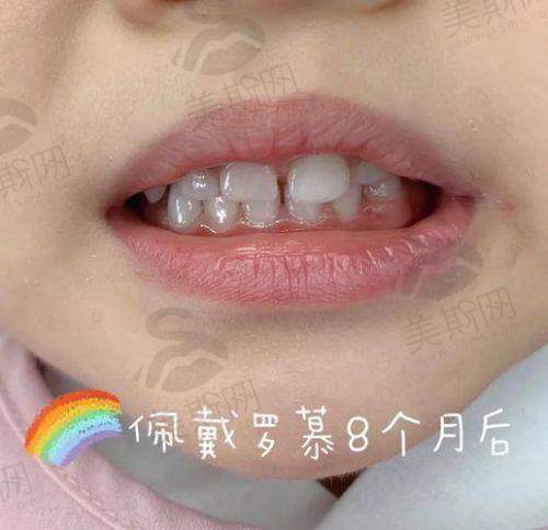 2、天津诺尔口腔门诊部是正规医院吗？