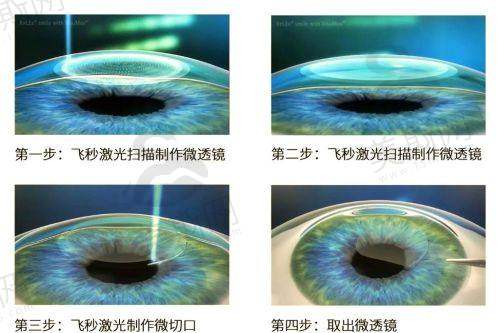九、福建省人民医院眼科地址电话