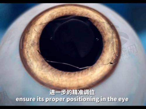 东莞市厚街医院眼科诊疗项目