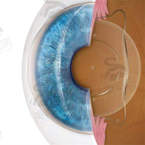 大连庄河爱尔眼科医院诊疗项目