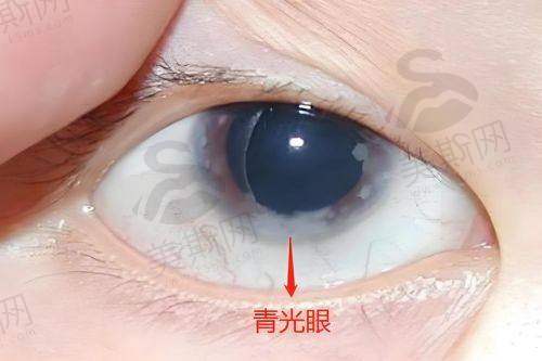 九、大连普兰店爱尔眼科医院口碑评价一览