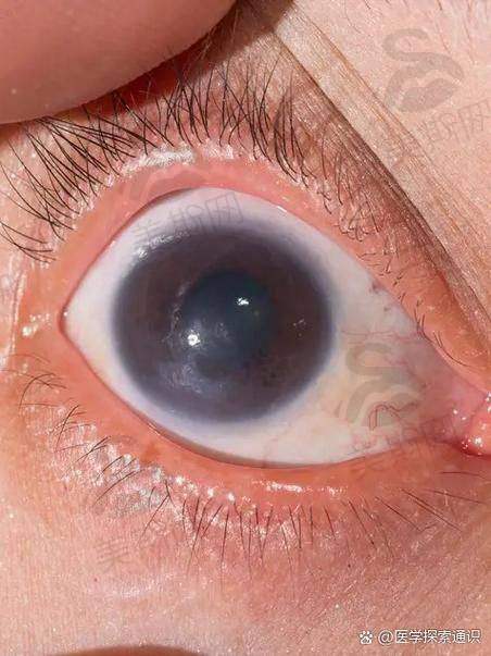 六、佛山禅城爱尔眼科诊所特色技术