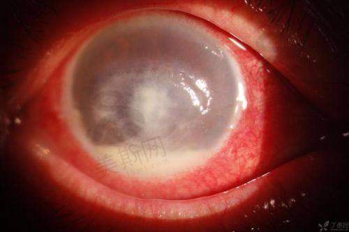 大连庄河爱尔眼科医院正规靠谱吗？