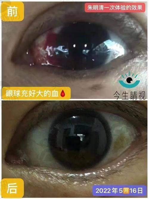 十、佛山禅城爱尔眼科诊所预约挂号