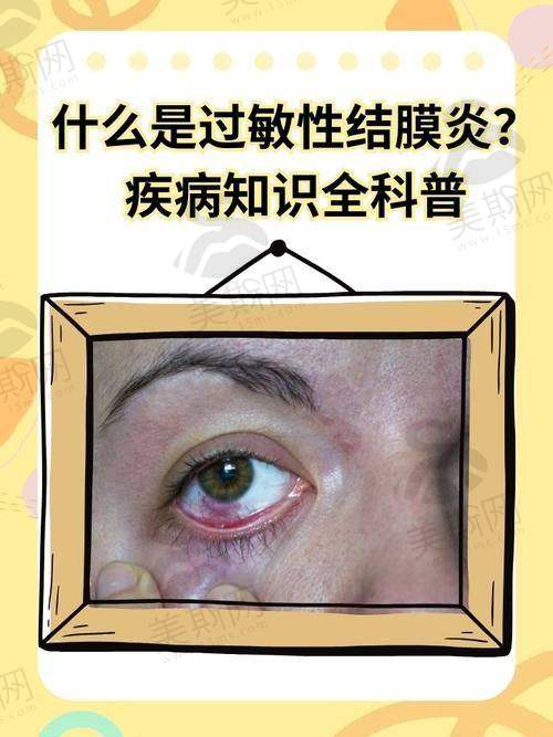 七、东莞友华普惠眼科医院价格表/收费标准参考