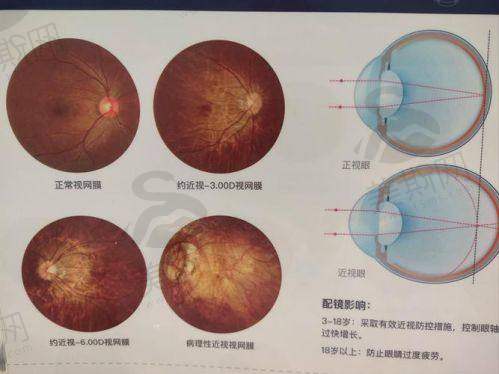 十一、大连普兰店爱尔眼科医院预约挂号