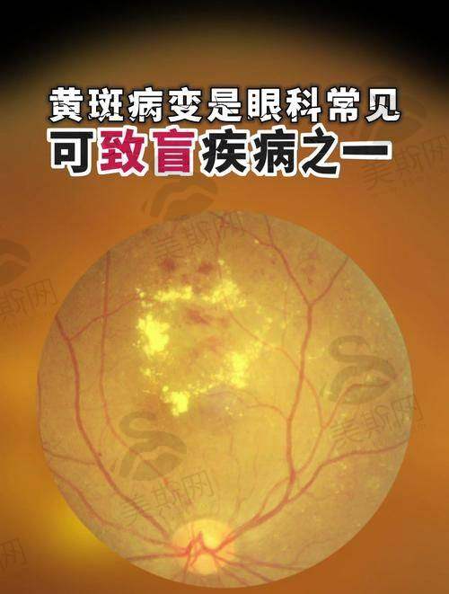 东莞市厚街医院眼科正规靠谱吗?