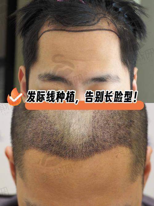 佛山梦露整形医院收费标准
