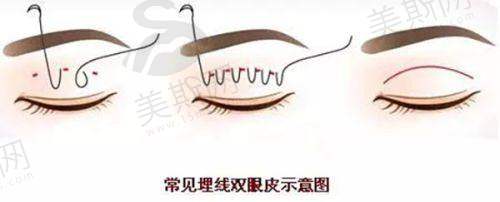 与其他植发医院的对比