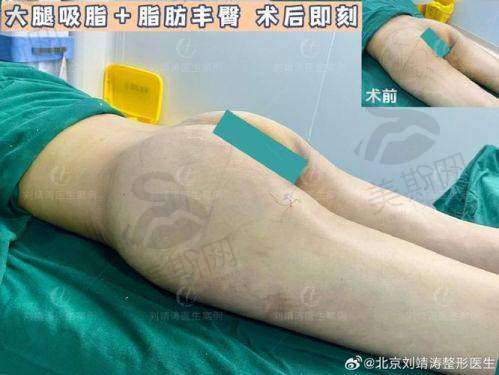 武汉十大正规整形医院排名技术优势
