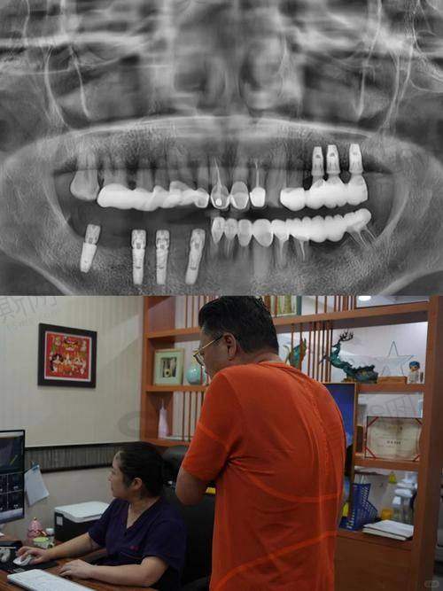 深圳尔睦口腔连锁门诊部特色技术