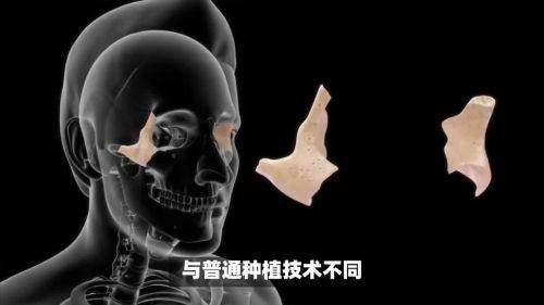 总结