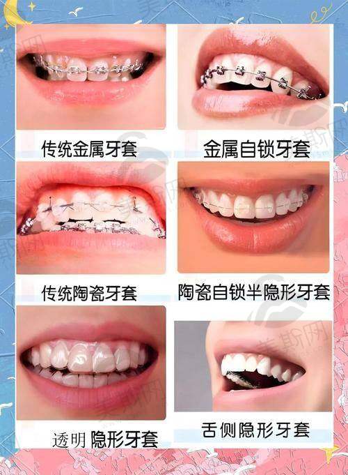 深圳同步齿科连锁医院是国有的吗属于几级？