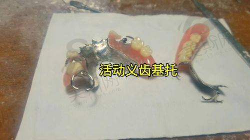上海夕阳红口腔收费价格