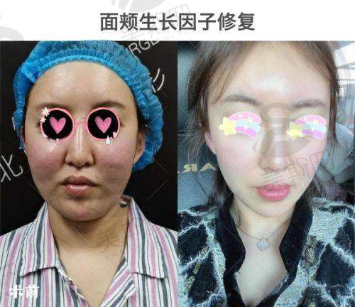 潘丽琴医生擅长项目