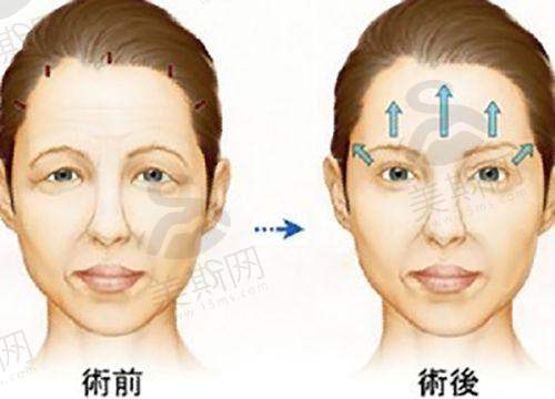 潘丽琴医生技术水平高