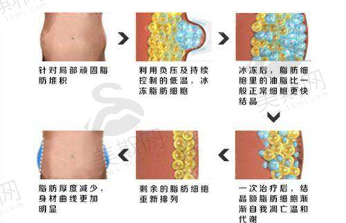 潘丽琴医生预约挂号