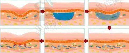 潘丽琴医生2025年价格表