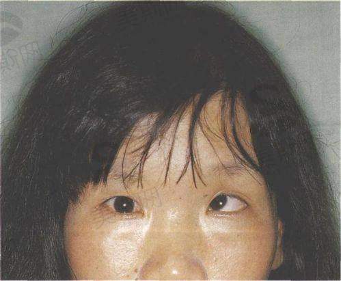 西 南医 科 大学附属医院眼科正规吗?