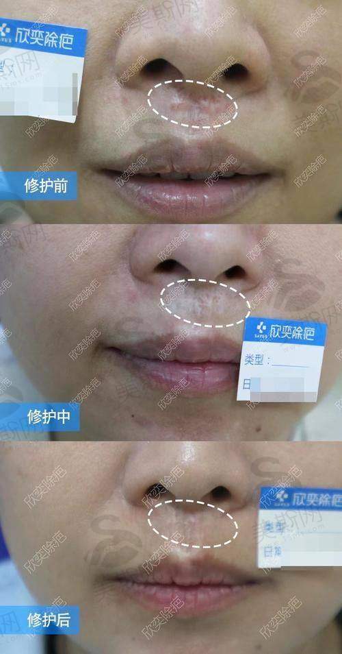 重庆军科疤痕中 心怎么样？