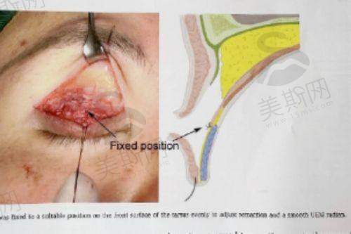 田艳医生坐诊医院:上海美莱医疗美容医院