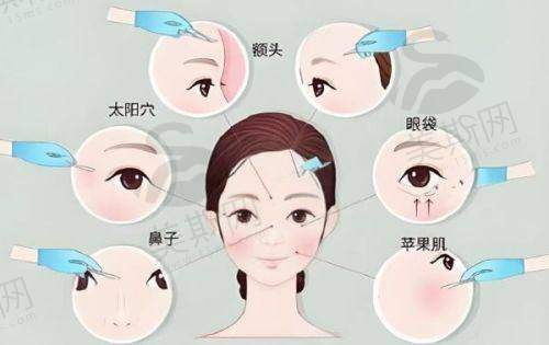 价格优势与选择建议