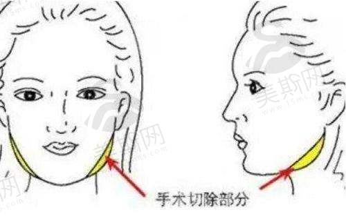 选择秦皇岛和生医疗美容门诊部的理由