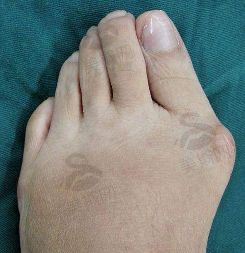 荆门金瀚医疗美容医院多项医美项目价格实在，填充苹果肌、祛副乳、除皱各有收费标准