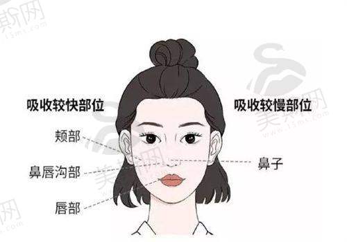 面部轮廓整形项目