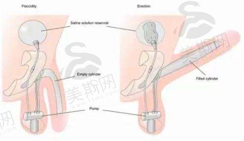 其他医美项目：丰富选择，满足多样需求