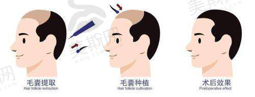 选择秦皇岛匠心医美的优势